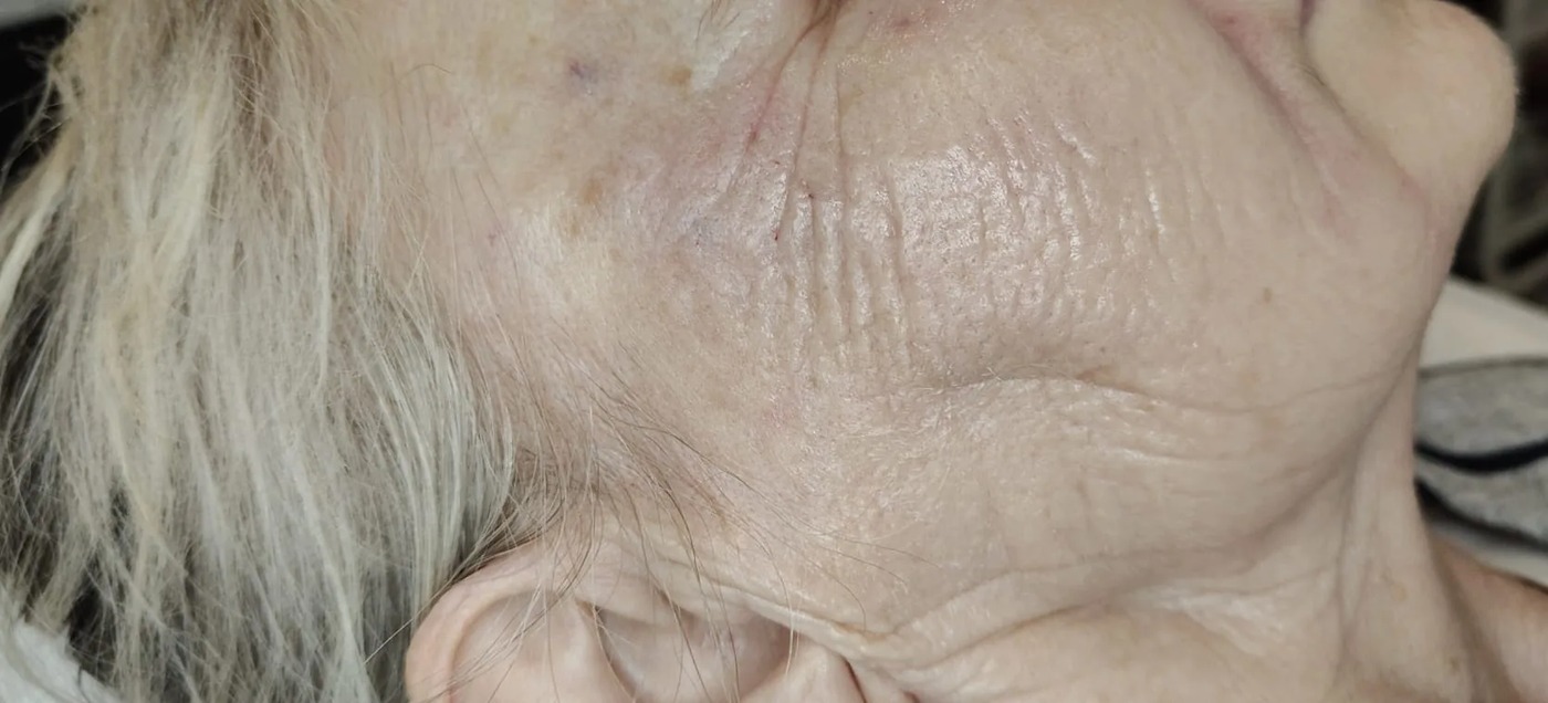 Terapia Healthy Aging – po